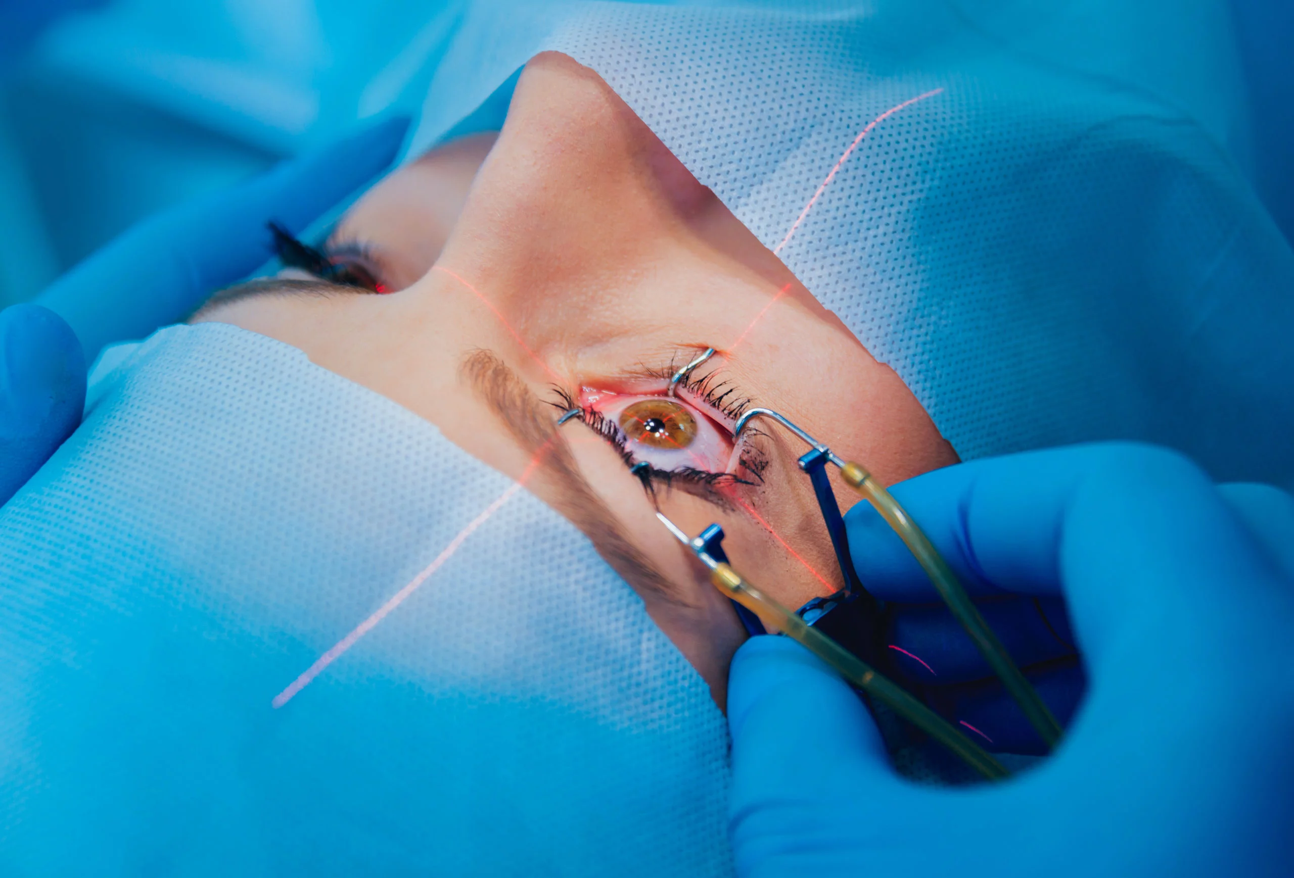 Cataract-Surgery-Dr-Agarwals-Eye-Hospital-scaled