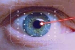 6443f5f5b620a99f3fabb1e9lasik (1) 6443f5f5b620a99f3fabb1e9lasik (1)